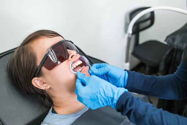 Best Teeth Whitening  in Anna, OH