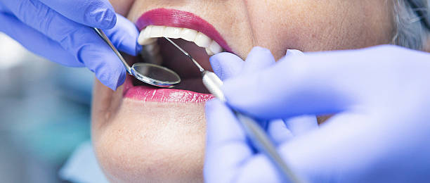 Best Chipped Tooth Repair Near Me  in Anna, OH